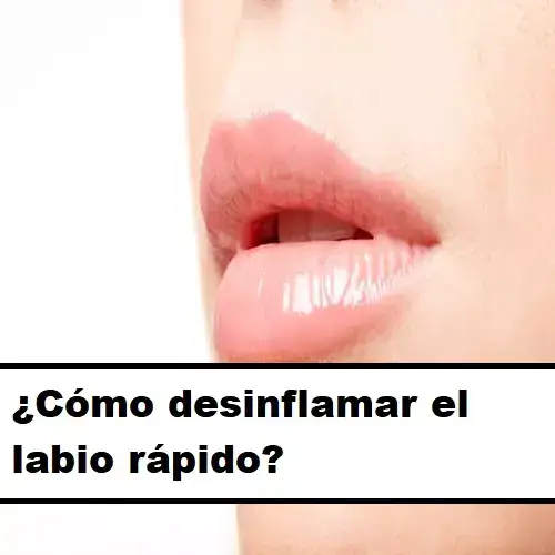 ¿Cómo desinflamar el labio rápido?